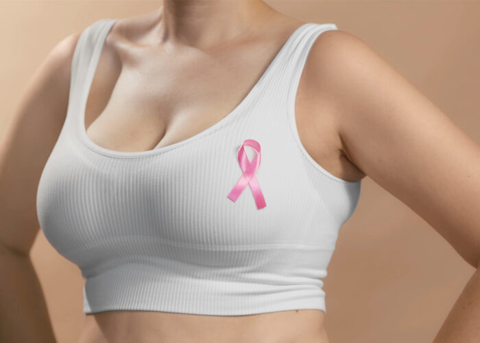 Καρκίνος Μαστού: Επαναστατικές θεραπείες